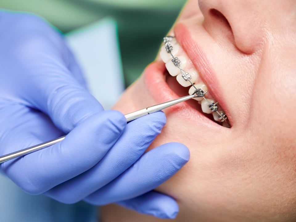 Счастливые дни в ортодонтии