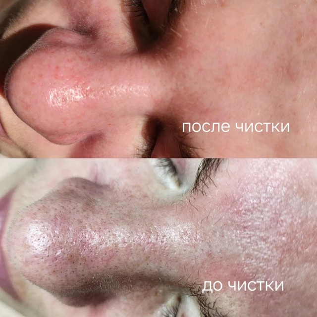 Пример работы