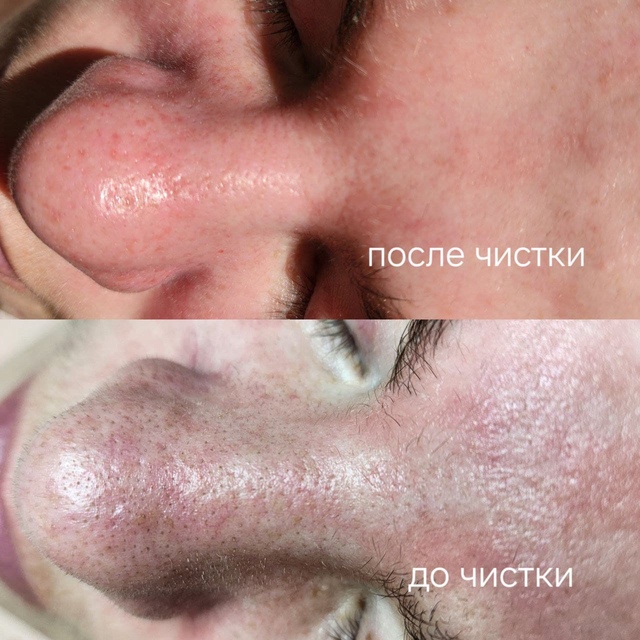 Пример работы