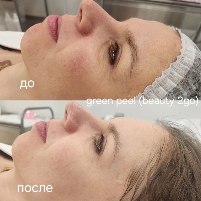 Пример работы