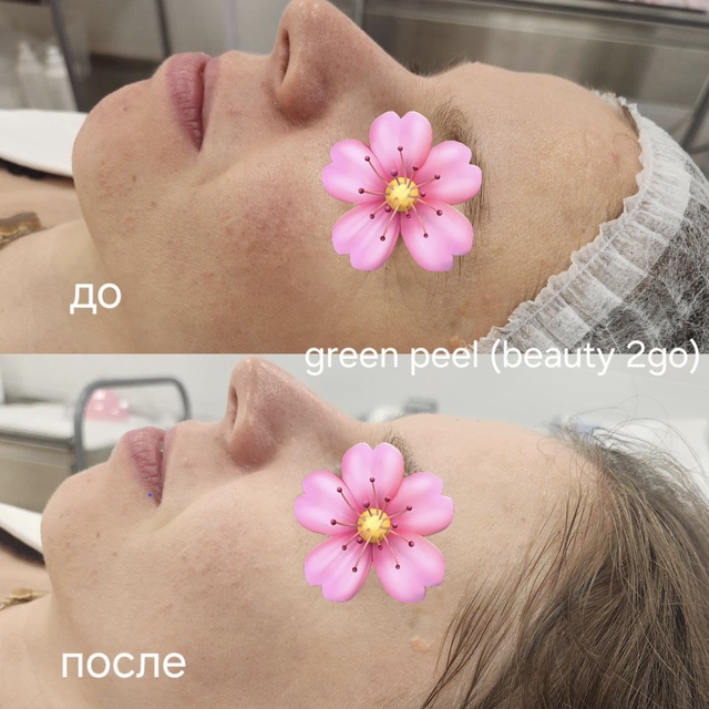 Пример работы