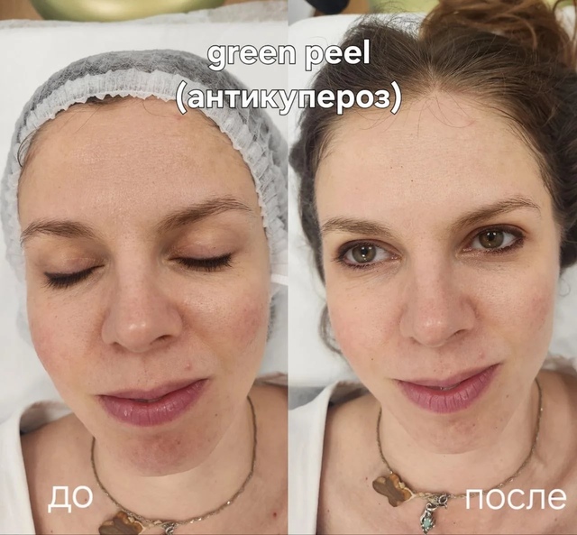 Пример работы