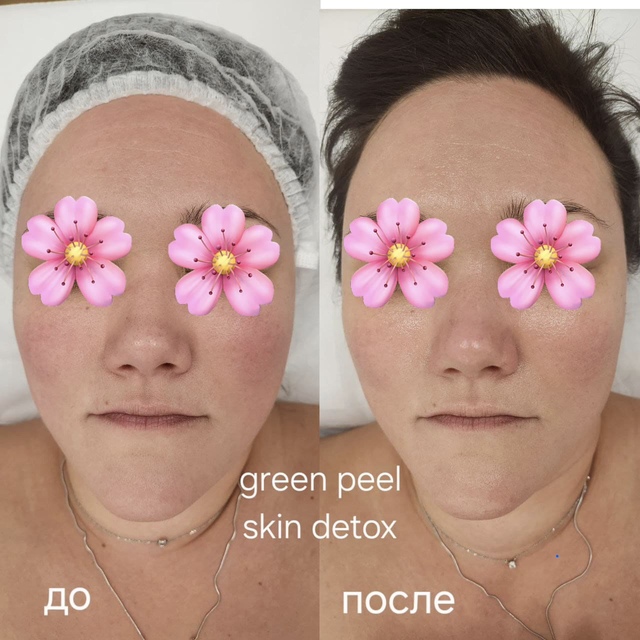 Пример работы