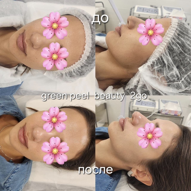 Пример работы