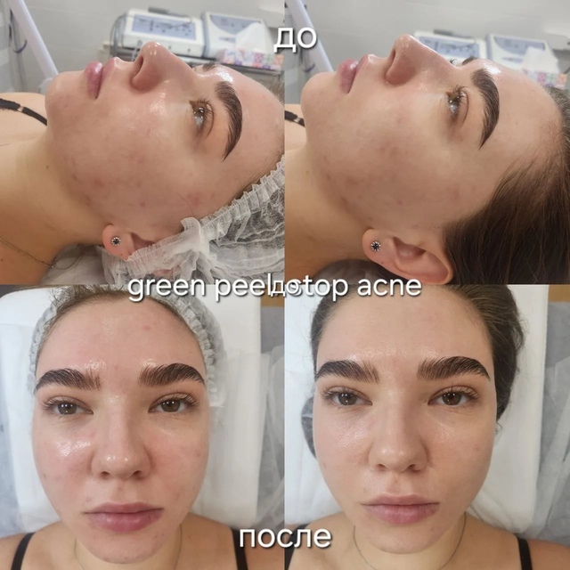 Пример работы