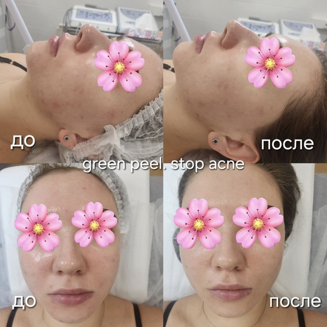 Пример работы