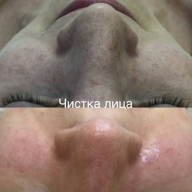 Пример работы