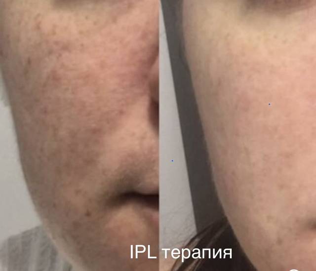 Пример работы