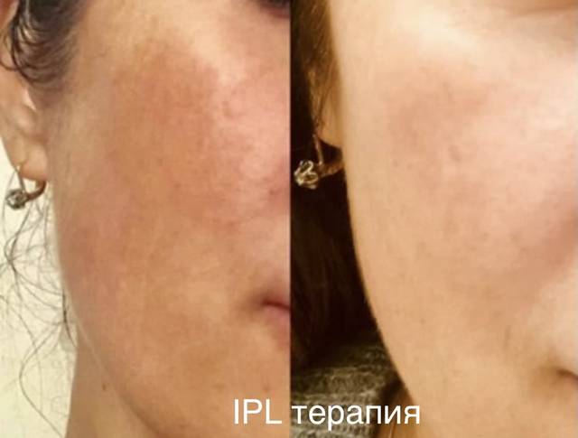 Пример работы