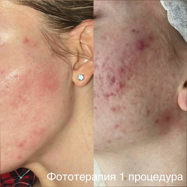 Пример работы