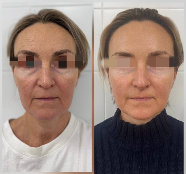 Пример работы