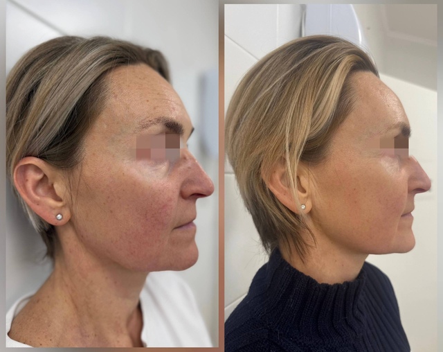 Пример работы