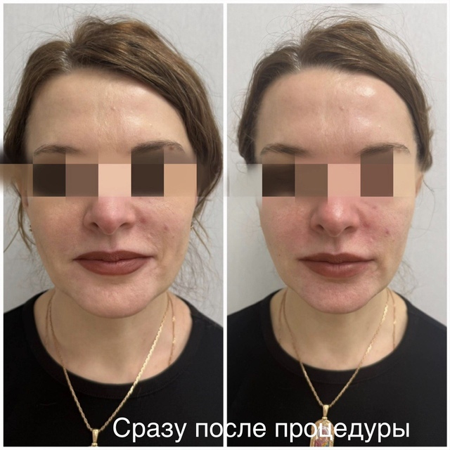 Пример работы