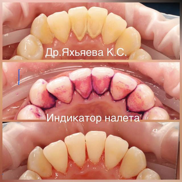 Пример работы