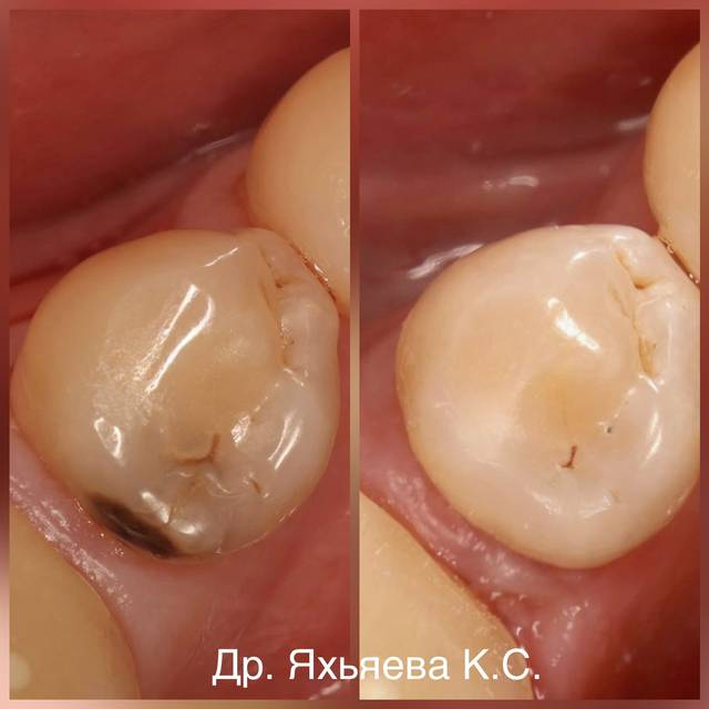 Пример работы